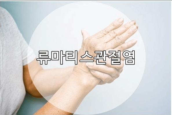 염증질환 류마티스 관절염 젤잔스정 주의사항 5가지